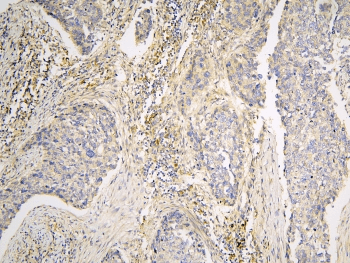 Polyclonal Rabbit anti-Human PPA1 Antibody (IHC, WB)