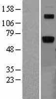 ARSB / Arylsulfatase B Protein (Over-Expression Lysate Myc-DDK (Flag))