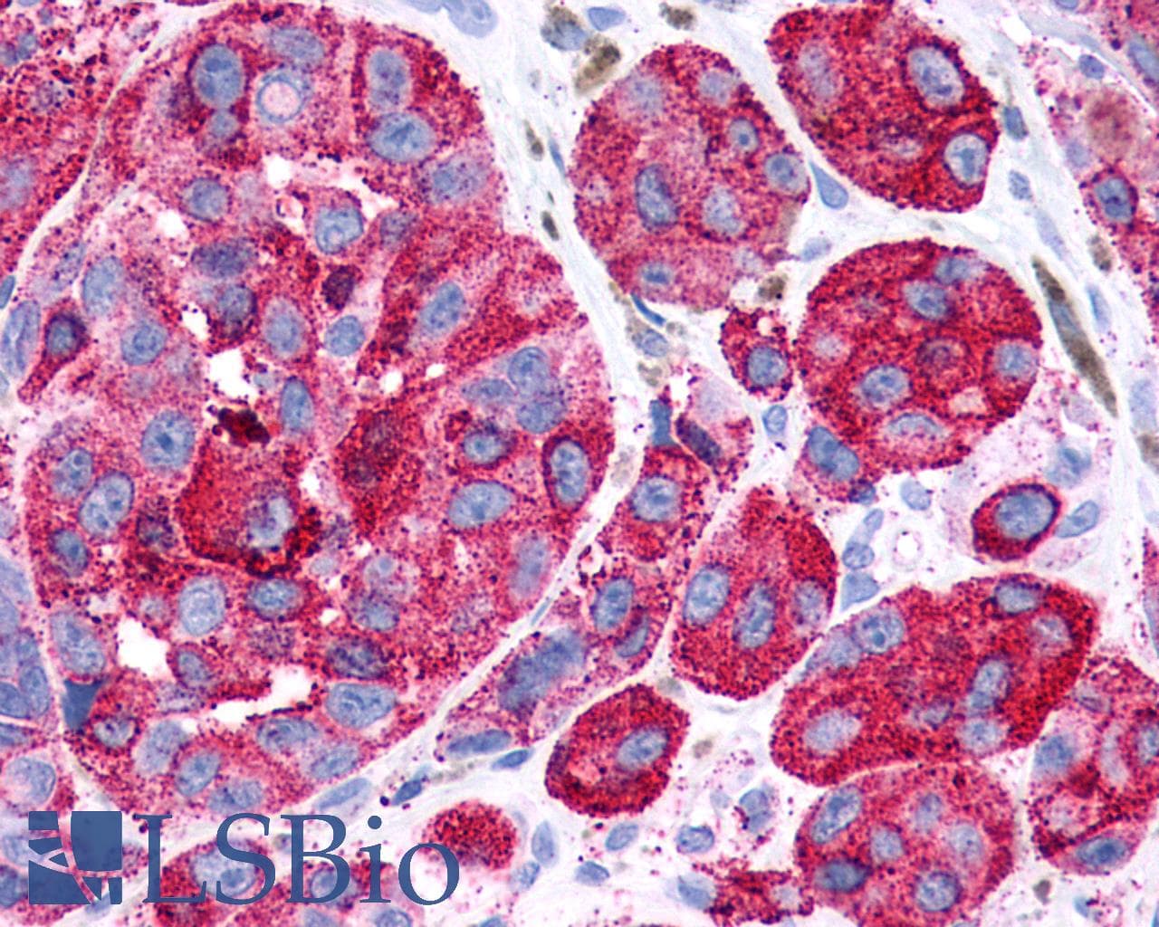 PathPlus™ Polyclonal Rabbit anti-Human ADGRF5 / GPR116 Antibody (Cytoplasmic Domain, IHC)