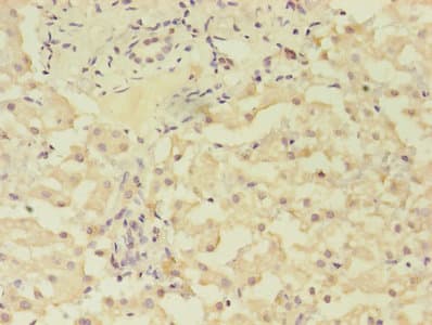 GRK4 Antibody (aa1-245)