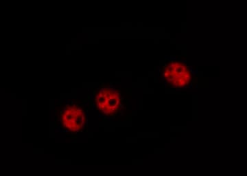 NFKB1 / NF-Kappa-B Antibody (phospho-Ser337)