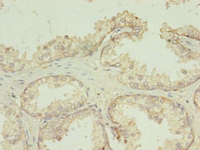 TMEM141 Antibody (aa1-108)