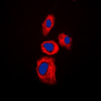 AIM2 Antibody (Internal)