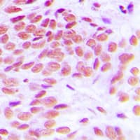 GATA1 Antibody (Internal)