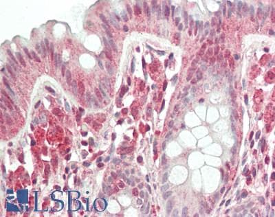 IHC-plus™ Polyclonal Rabbit anti-Human Heat Shock Protein 70 / HSPA1A Antibody (IHC, IF, WB)