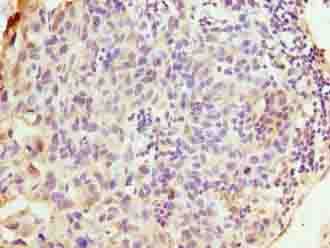 WDR62 Antibody