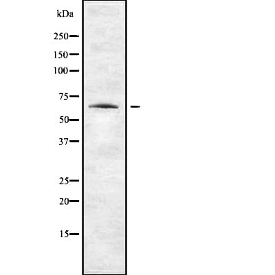 Polyclonal Rabbit anti-Human ENC1 Antibody (WB)