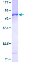 Human SERPINB6 / PI-6 Protein (Recombinant GST)