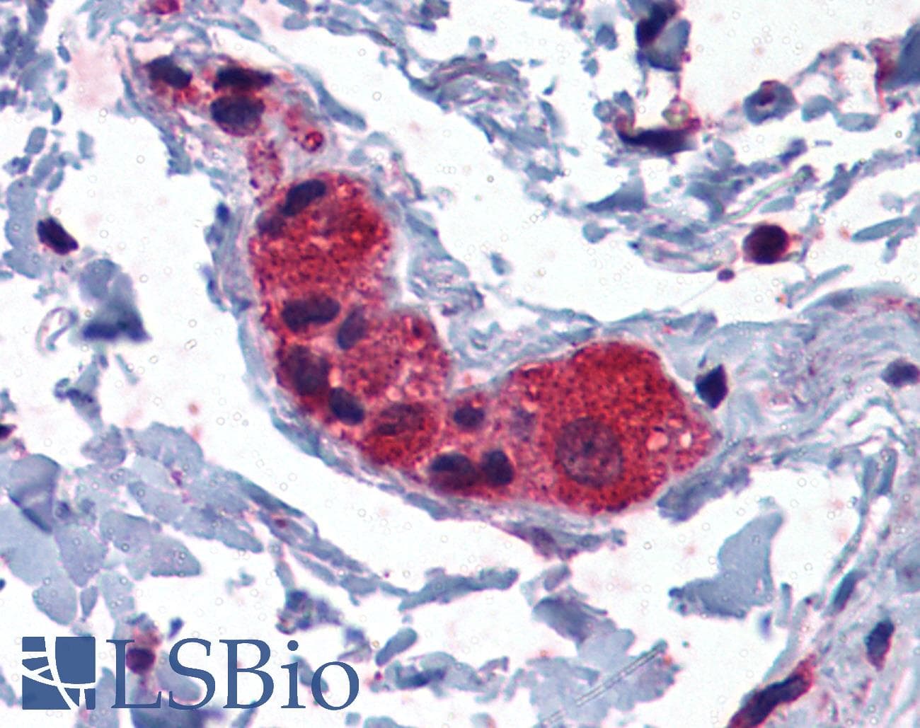 IHC-plus™ Polyclonal Goat anti-Human MYRIP Antibody (aa846-859, IHC, WB)