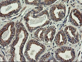 UBE2J1 Antibody (clone OTI3E6)