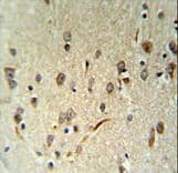LIMD2 Antibody (aa84-113)