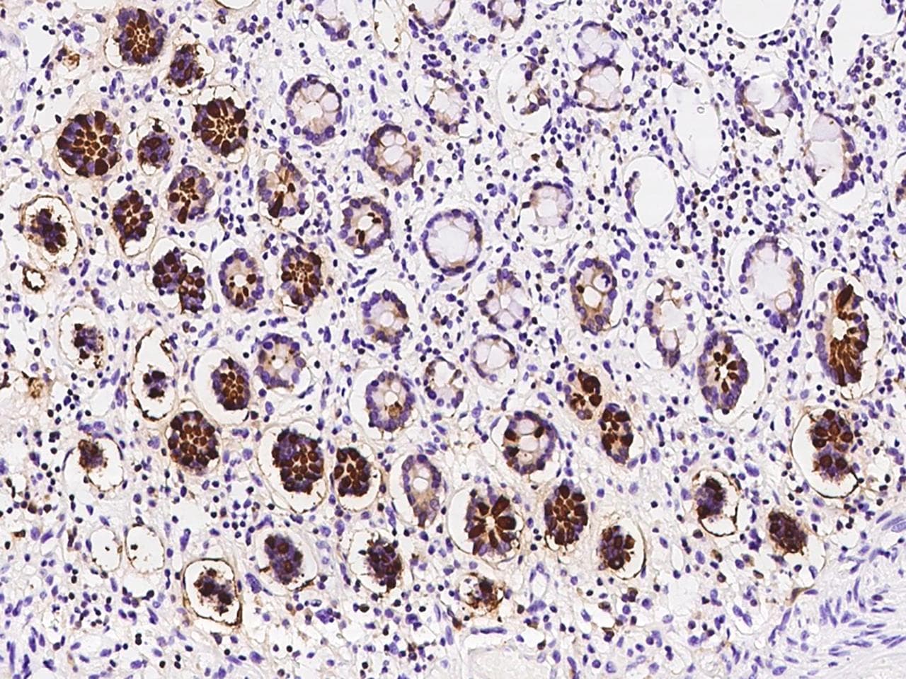 Polyclonal Rabbit anti-Human DEFA6 / Defensin 6 Antibody (IHC)