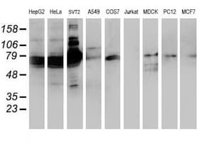 Monoclonal Mouse anti-Human SAMHD1 Antibody (clone OTI2A5, IHC, IF, WB)