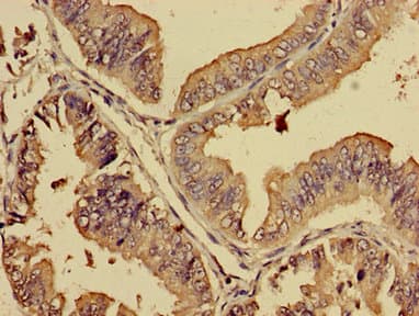 Polyclonal Rabbit anti-Human PREB Antibody (IHC, WB)