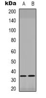 PITX1 Antibody (Internal)