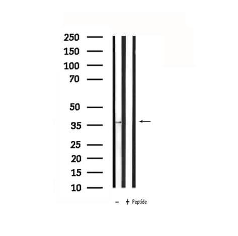 Polyclonal Rabbit anti-Human ADORA2A/Adenosine A2A Receptor Antibody (IHC, IF, WB)