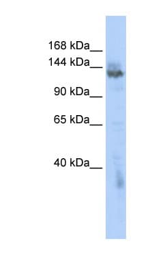 ZMYND8 / RACK7 Antibody (aa1115-1164)