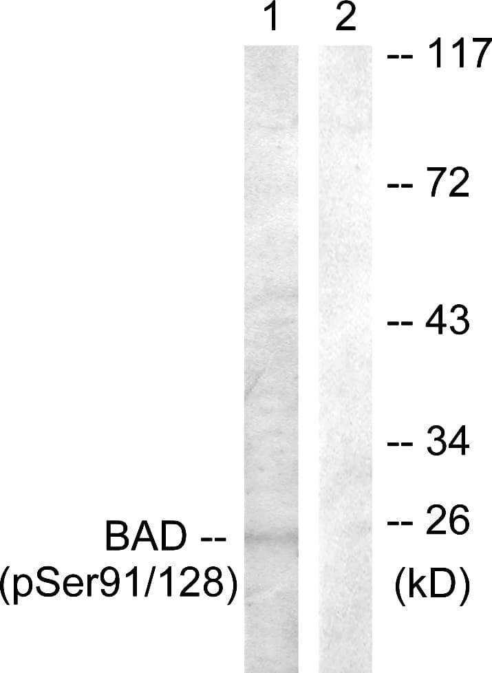 BAD Antibody (phospho-Ser91/Ser128)