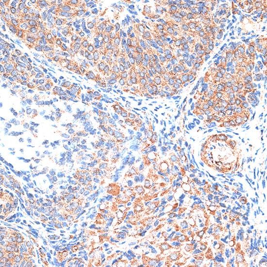 TIMP2 Antibody