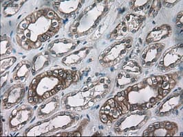 KRT18 / CK18 / Cytokeratin 18 Antibody (clone OTI5E8)