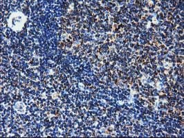 CLPP Antibody (clone OTI1C7)