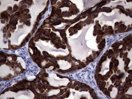 Monoclonal Mouse anti-Human KRT19 / CK19 / Cytokeratin 19 Antibody (clone OTI1E7, aa240-390, IHC)