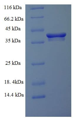Human RAB6A / RAB6 Protein (Recombinant His-SUMO)