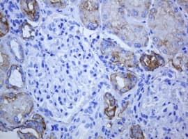 ABCB1 / MDR1 / P Glycoprotein Antibody (aa995-1280, clone 6H2, Carrier-free)