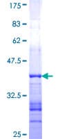 Human GRID2 Protein (Recombinant GST, N-terminus)