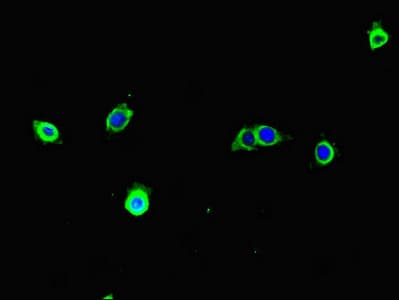 Polyclonal Rabbit anti-Human TECPR1 Antibody (IHC, IF)