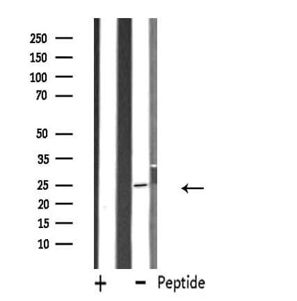 FEV / PET1 Antibody