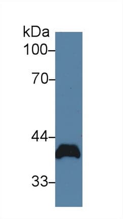 PVR / CD155 Antibody (aa22-255)