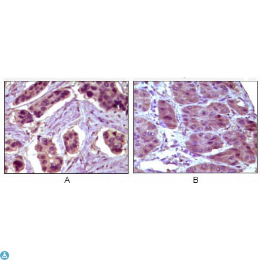 BCL10 / BCL-10 Antibody