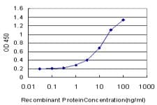 HNE / Neutrophil Elastase Antibody (clone 4E12)