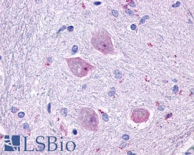IHC-plus™ Polyclonal Rabbit anti-Human CHRM4 / M4 Antibody (Cytoplasmic Domain, IHC)