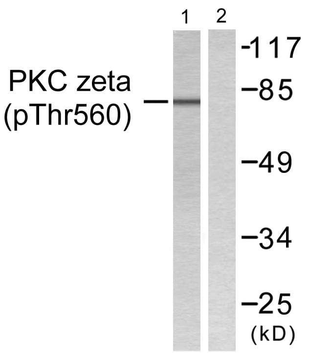 PRKCZ / PKC-Zeta Antibody (phospho-Thr560)