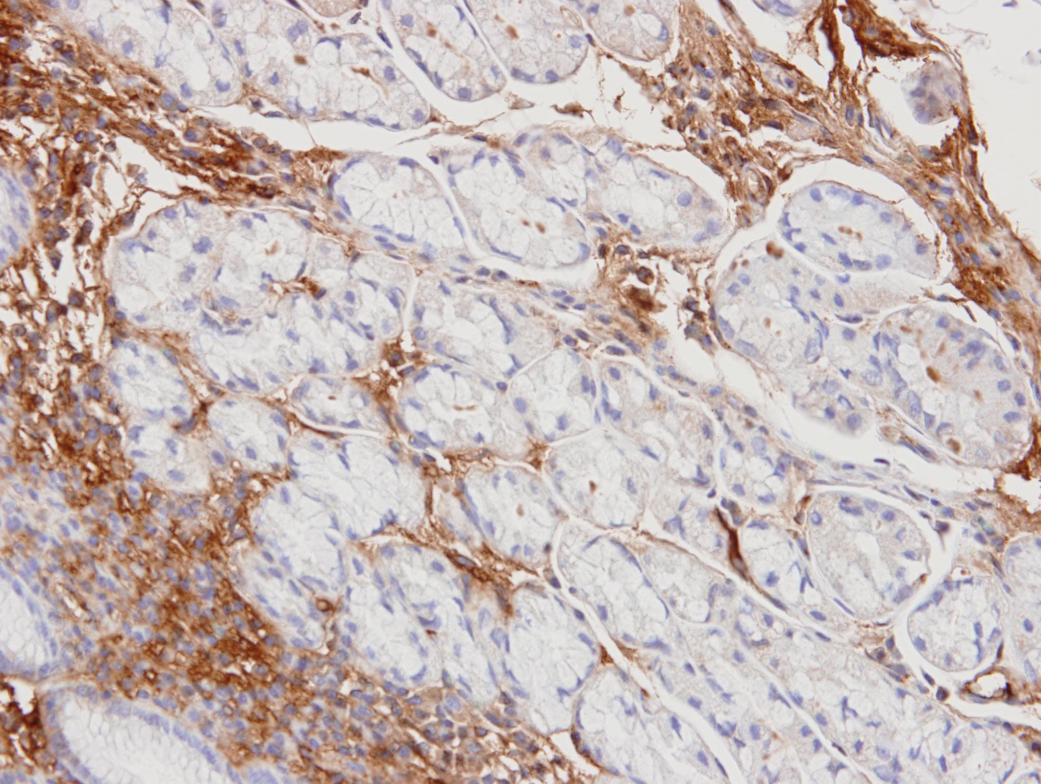 HP / Haptoglobin Antibody (aa57-406)