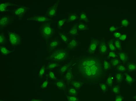 Polyclonal Rabbit anti-Human ERCC1 Antibody (IHC, IF, WB)