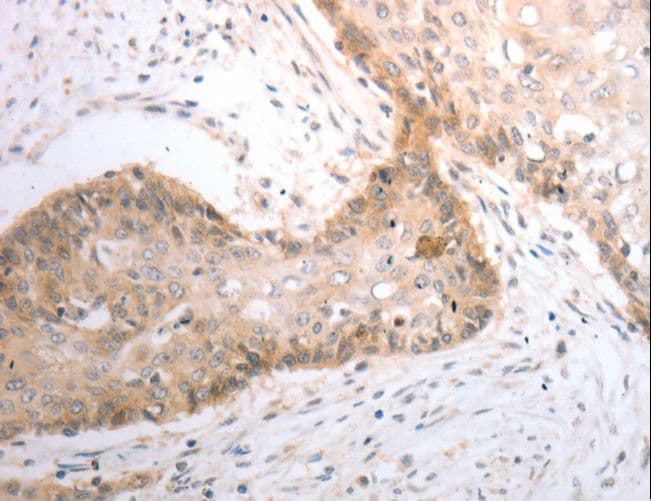 Polyclonal Rabbit anti-Human SLC1A4 / ASCT1 Antibody (IHC, WB)