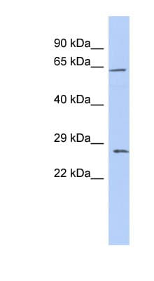 CLDN18 / Claudin 18 Antibody (C-Terminus)