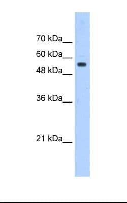 PODXL / Podocalyxin Antibody (aa301-350)