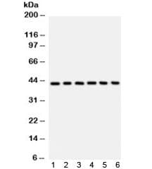Polyclonal Rabbit anti-Human SELL / L-Selectin / CD62L Antibody (IHC, WB)