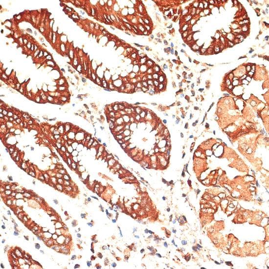 KRT13 / CK13 / Cytokeratin 13 Antibody