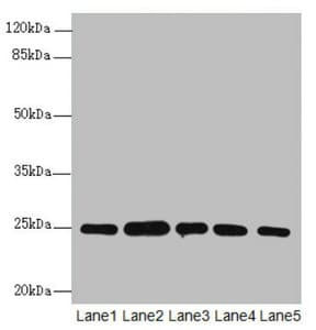 RAB5B Antibody