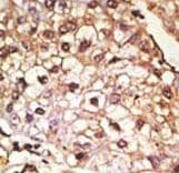 Polyclonal Rabbit anti-Human SNCA / Alpha-Synuclein Antibody (aa75-104, IHC, WB)