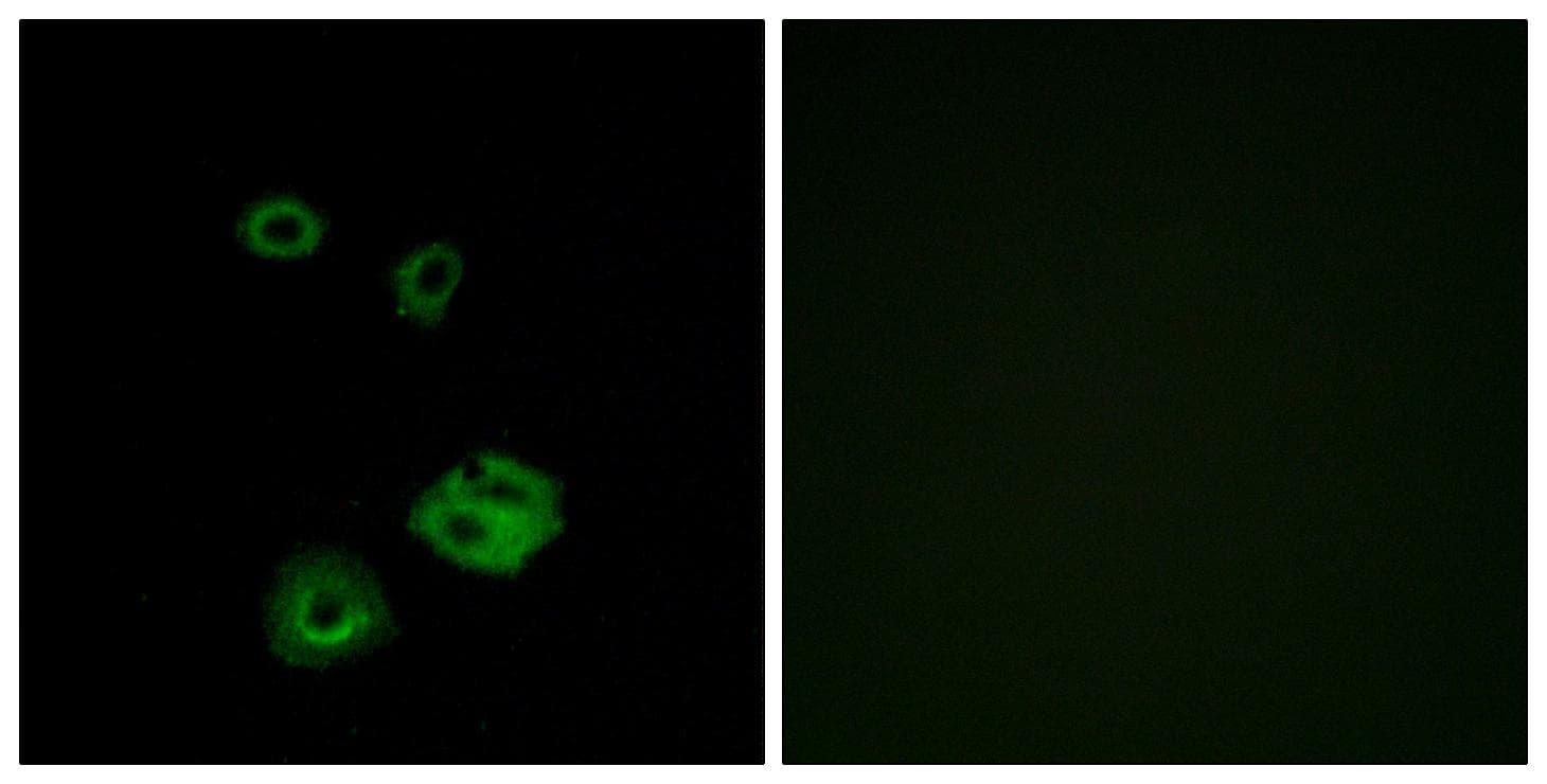 Polyclonal Rabbit anti-Human NPY2R Antibody (IF, WB)