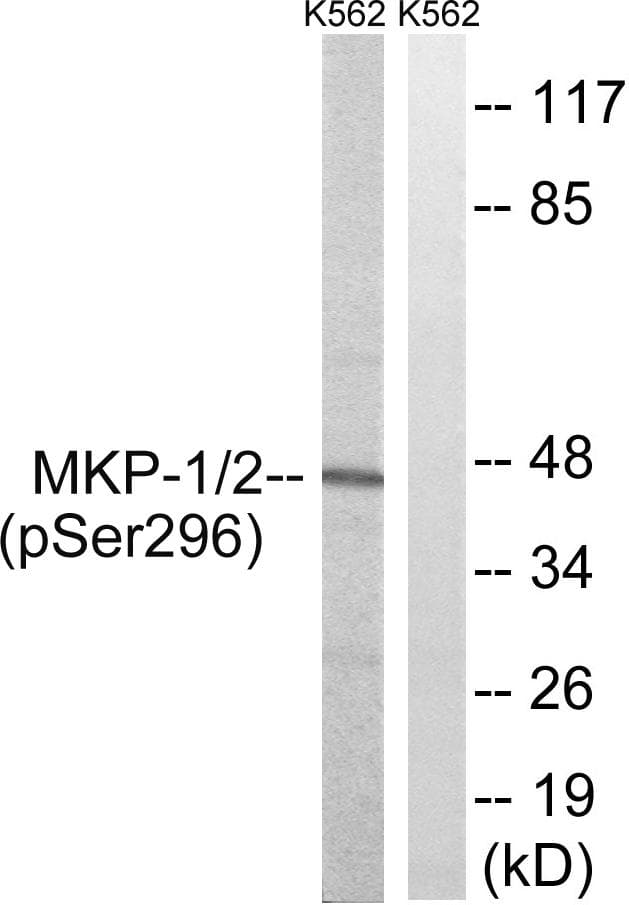 Polyclonal Rabbit anti-Human MKP1 + MKP2 Antibody (phospho-Ser296/318, IHC, WB)