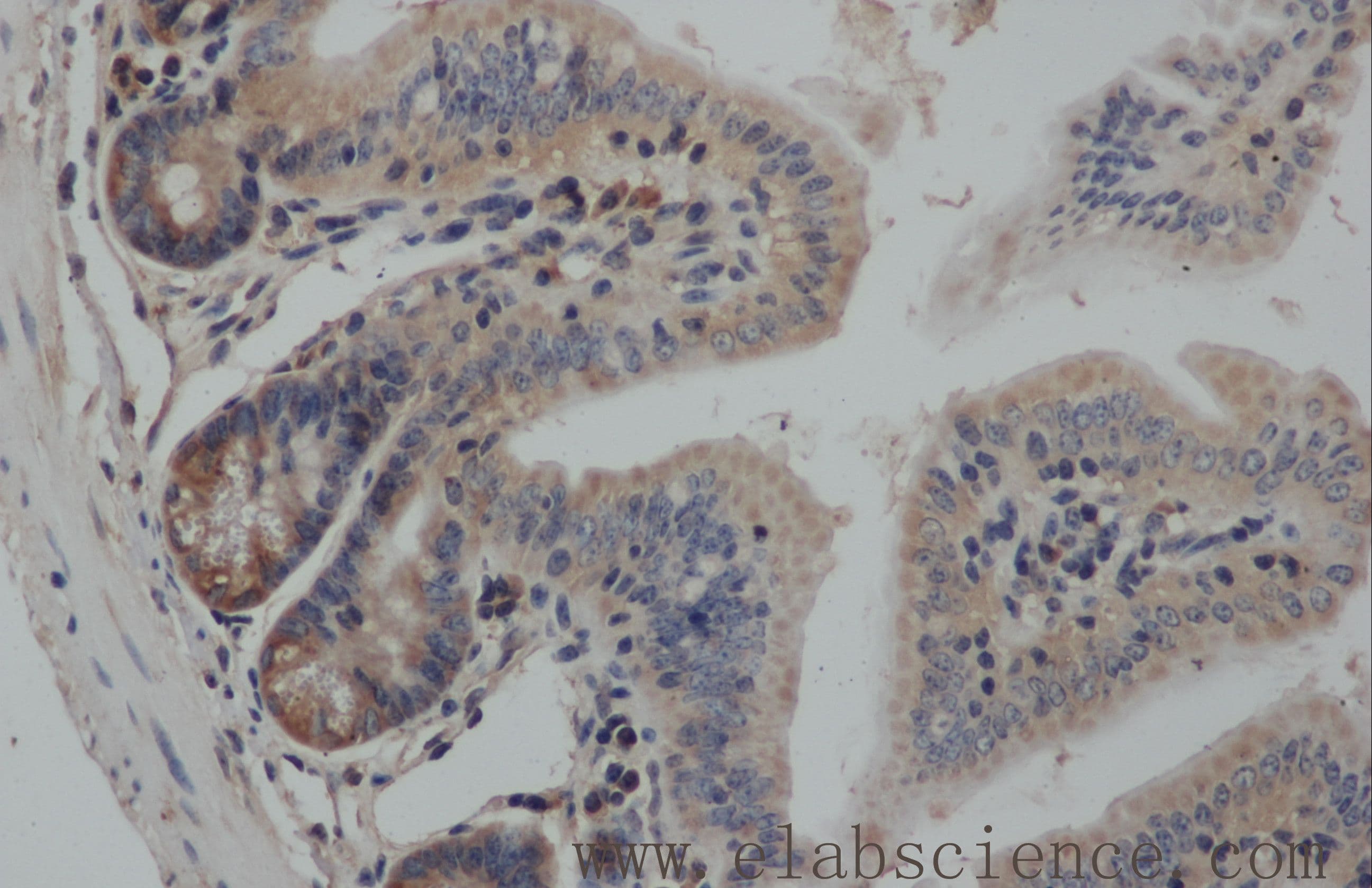 SMAD3 Antibody
