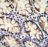 ECT2L Antibody (aa725-753)