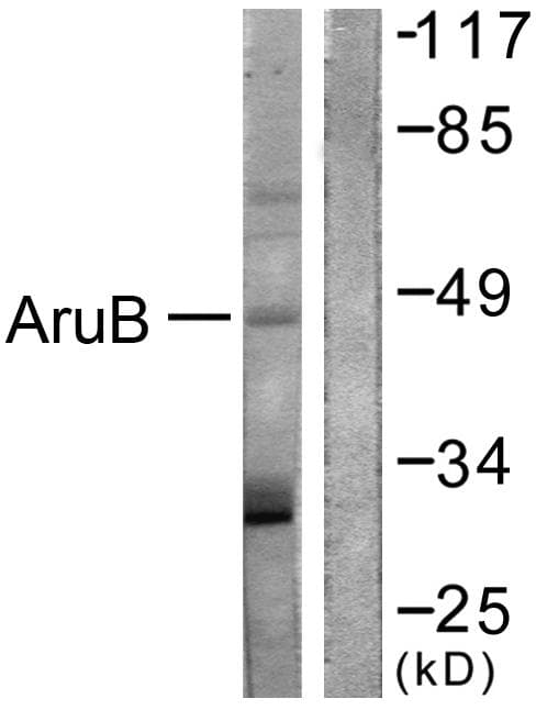 AURKB / Aurora-B Antibody (p12)